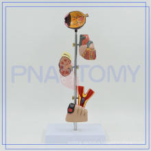 PNT-0758 high quality diabetes model,medical diabetes sets